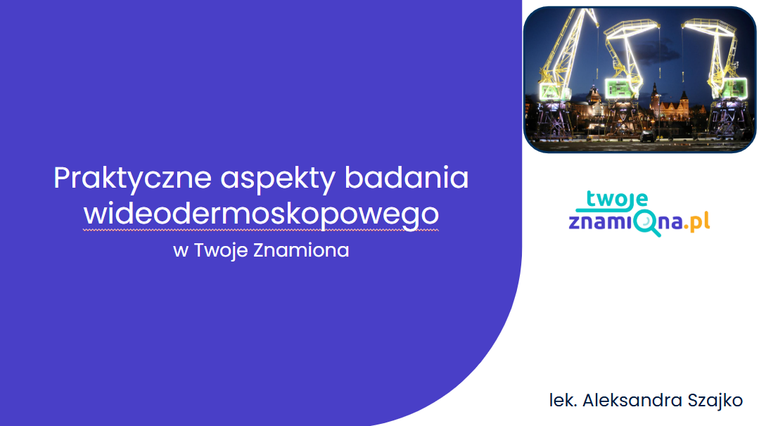 Praktyczne aspekty badania wideodermoskopowego